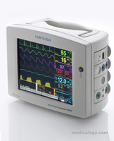 Patient Monitor Smart Sign SC 1000
