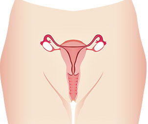 Khitan pada Wanita : FGM atau “Clitoral Un-hooding”