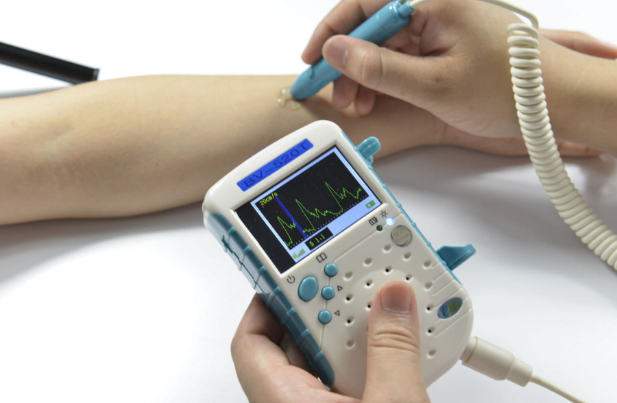 Vascular Doppler : Alat Deteksi Sumbatan Aliran Darah Vaskuler