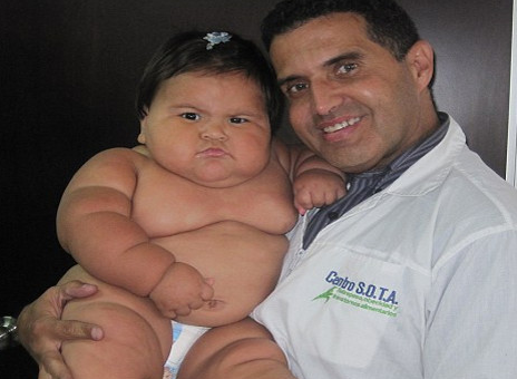 Prader-Willi syndrome, Bagi Kalian Yang Tidak Bisa Berhenti Makan, Baca dan Berwaspadalah!