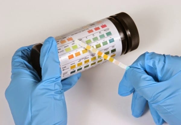 Pemeriksaan Urine Dengan Urine Analyzer