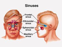 images.sinusitis.