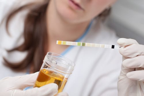 5 Penyakit Ini Bisa Dideteksi Dari Urin