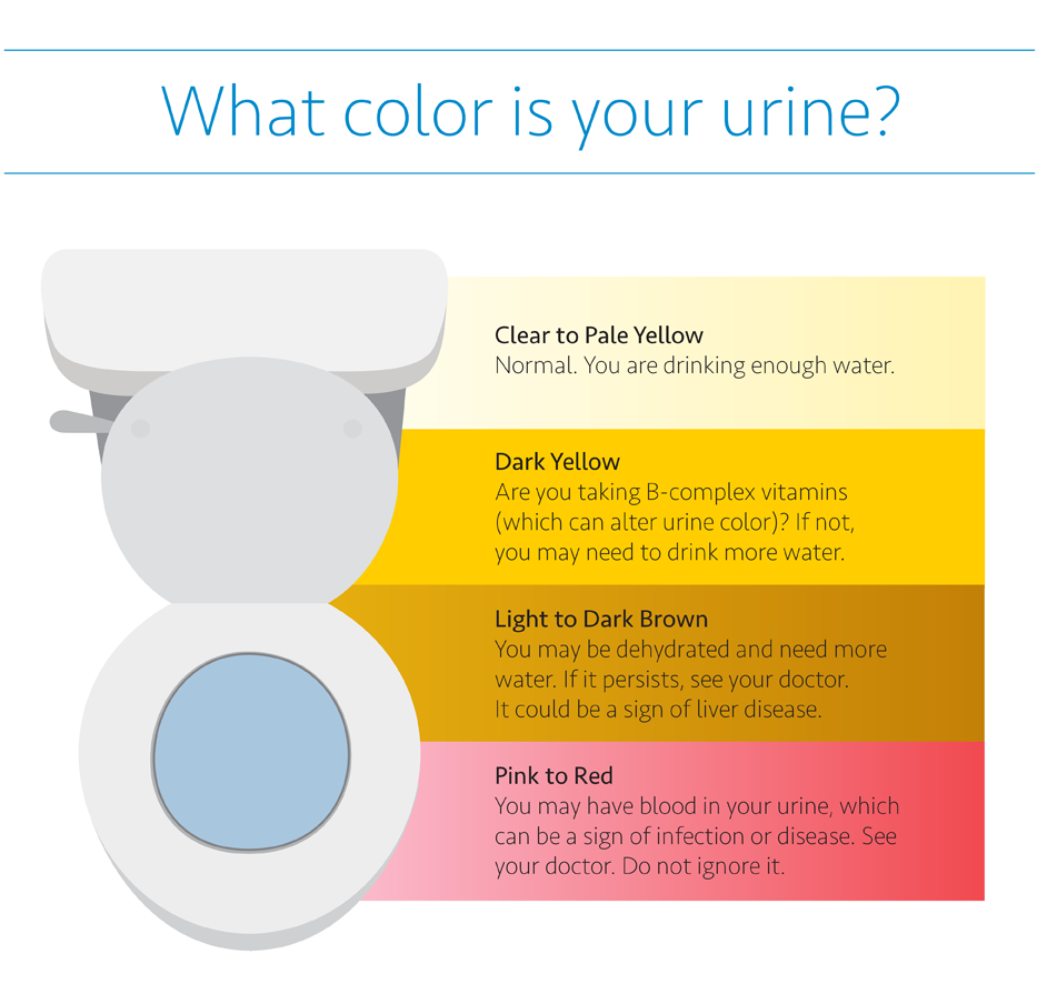 Urine color infographic 1200