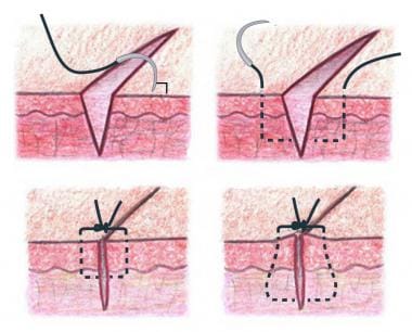 gambar dokumen medscape