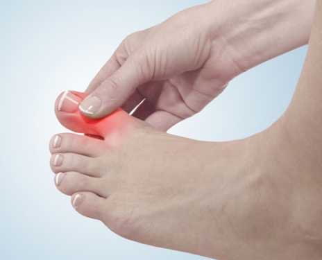 12 Tips Beli Alat Tes Asam Urat dengan Gampang