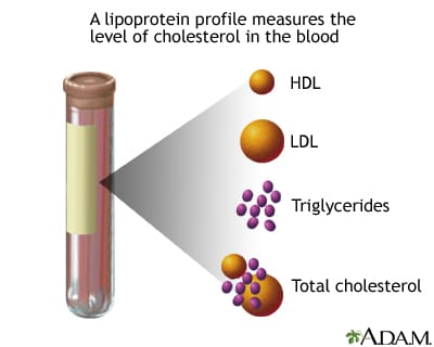 Cek Kolesterol Saja Tidak Cukup, Lengkapi Dengan Cek Lipid Darah