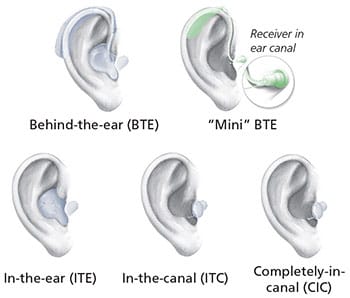 Jenis Alat Bantu Dengar Sumber National Institute of Deafness and Other Communication Disorder (NIDCD)