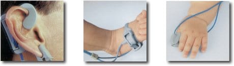 Tepat pemasangan Pulse Oximeter dok FRCA