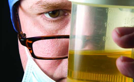 Ini Daftar Harga Urine Analyzer Murah