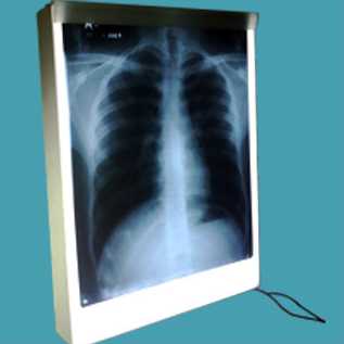 Berapa Harga X Ray Viewer?