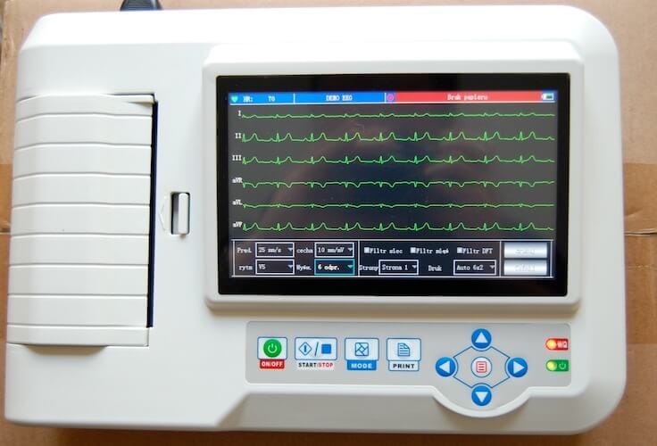 EKG, Mesin Pintar Pendeteksi Aktivitas Jantung