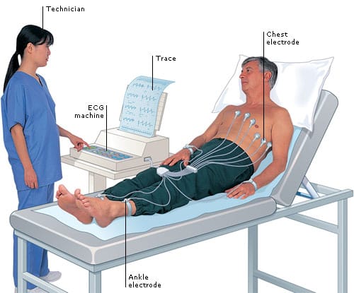 cfhg358ecg_001