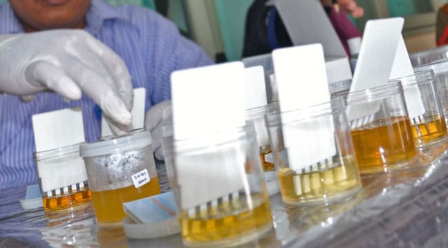 Urine Analyzer