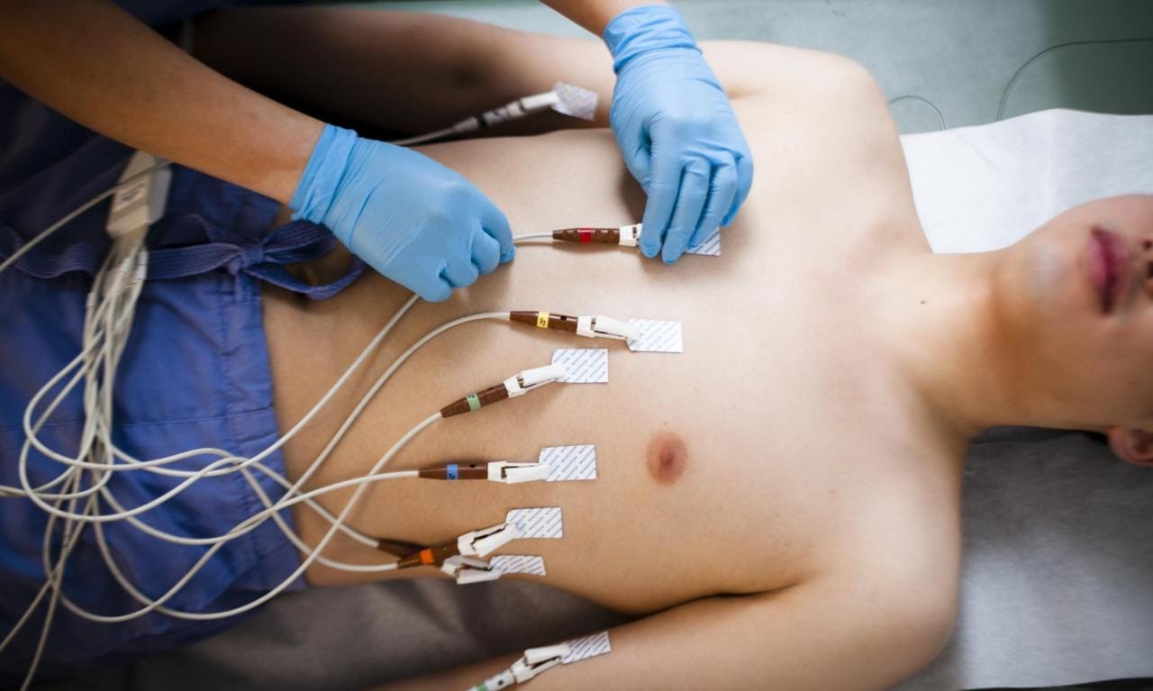 EKG, ECG, elektrokardiogram
