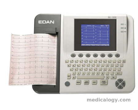 Yang Perlu Pasien Ketahui Mengenai Tes Elektrokardiogram (EKG)