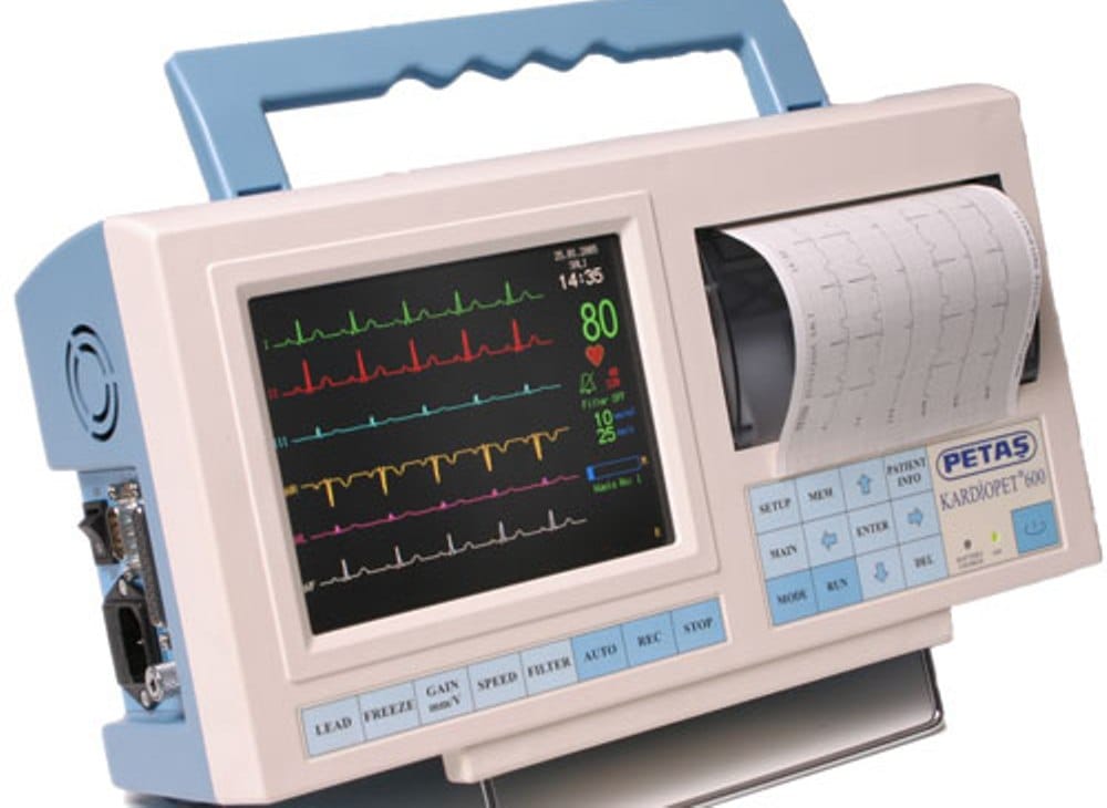 elektrokardiogram