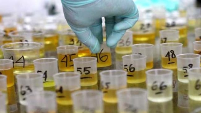 Pemeriksaan Urine Cepat Dengan Urine Strip