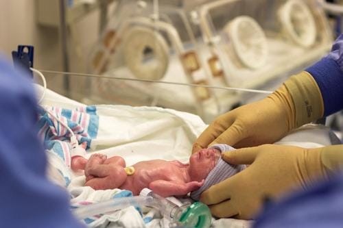 Inkubator Bayi Mendukung Kelangsungan Hidup Bayi