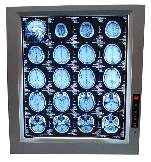 single-x-ray-viewer