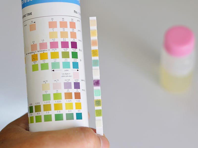 Urine Strip : Deteksi Banyak Penyakit Dengan Murah, Cepat, dan Praktis