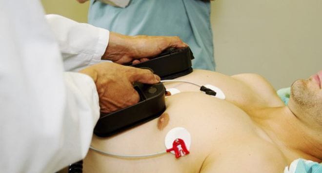 Cara Menggunakan Defibrillator