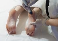Plantar fasciopathy or Jogger's heel Disease Treatment