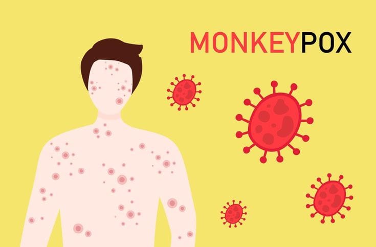 Download Monkeypox virus concept, woman suffering with rash on all body_ New orthopox virus outbreak pandemic spreading vector illustration for free