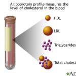 Cek Kolesterol Saja Tidak Cukup, Lengkapi Dengan Cek Lipid Darah