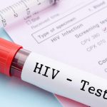 Rapid Test HIV, Cara Cepat Mendeteksi HIV