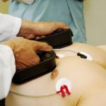 Cara Menggunakan Defibrillator
