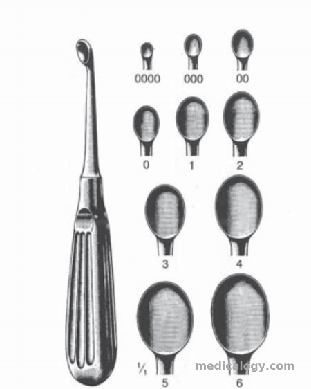 harga Dimeda Orthopedic Set VOLKMANN Bone Curette Fig.0