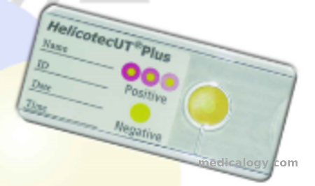 harga Oncoprobe Rapid Test H Pylori Antibody 25 Card/Box