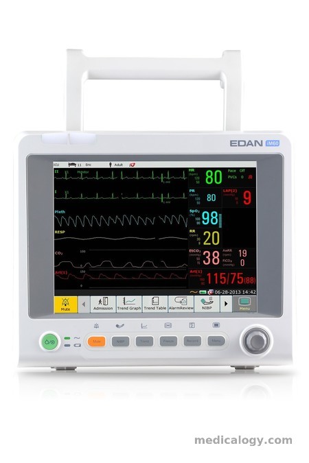 harga Patient Monitor Edan iM60 with EtCO2
