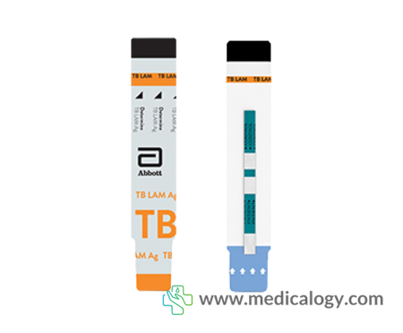 harga Rapid Test Determine TB LAM Ag SD Diagnostic 
