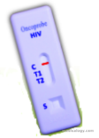 jual Oncoprobe Rapid Test HIV I dan II Antibody 25 Card/Box