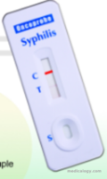 Oncoprobe Rapid Test Syphillis 25 Card/Box