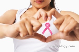 jual Voucher Paket Deteksi Dini Kanker pada Wanita