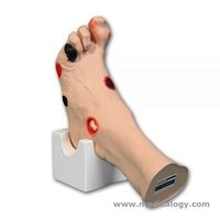 jual ‘Wilma’ Wound Foot™