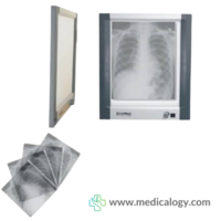 jual X Ray Film Viewer Single Onemed PD-GA