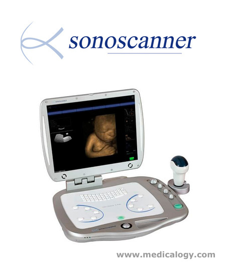 harga Ultrasound Scanner USG Color 3D/4D Orcheo Lite  Sonoscanner